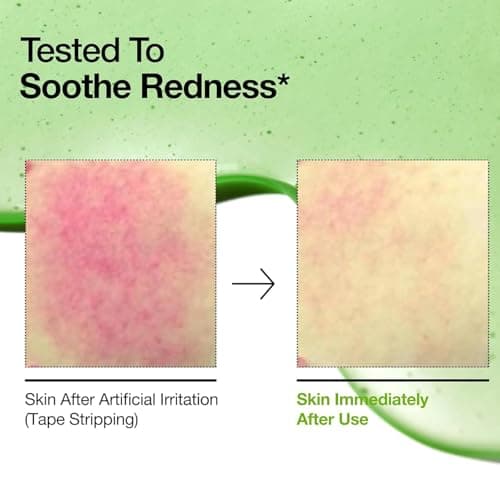 10% Azelaic Acid + Hyaluron - Beruhigendes Gesichtsserum für Reizhaftigkeit, Hautpflege und Anti-Ageing
| Azelainsäure