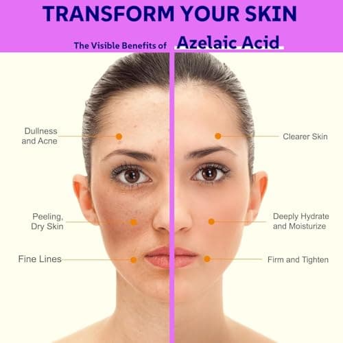 Azelainsäure Serum 12% für reife Haut mit Hyaluronsäure & Niacinamid
| Azelainsäure Serum 12% gegen Unreinheiten & Rötu