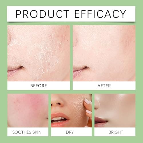 10% Azelaic Acid + Hyaluron - Beruhigendes Gesichtsserum für Reizhaftigkeit, Hautpflege und Anti-Ageing
| Azelainsäure