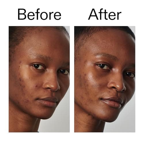 The INKEY List 10% Niacinamid-Serum, venezian, hauteigenschaftlich für alle Hauttypen, reduziert überschüssiges Öl, AM/