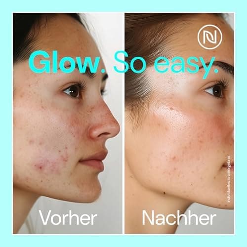 Zink Gesichtswasser Hydrolat: Spray-Toner für Alle Hauttypen mit 4% Niacinamid, 1% Zink PCA und BIO Aloe Vera (1 x 100ml