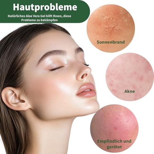 Natürliche Aloe Vera Feuchtigkeitscreme 99% Organisch Für Gesicht Und Körper - After Sun Pflege & Trockenheitsprobleme