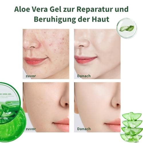 Natürliche Aloe Vera Feuchtigkeitscreme 99% Organisch Für Gesicht Und Körper - After Sun Pflege & Trockenheitsprobleme