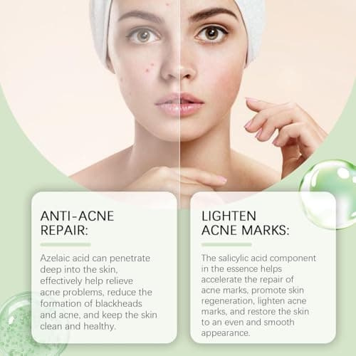 Azelain Serum, Beruhigt Trockene Haut, Verringert PorengrößE Und Hydratisiert