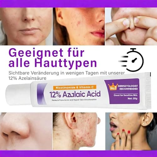12% Azelaic Acid Serum - Anti-Pickel-Creme für rosAceatische Haut
| Azelainsäure Serum - Porenverkleinerung & Pickelred