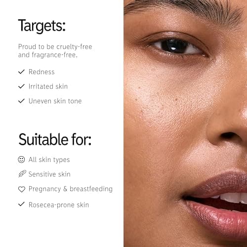 The INKEY List 10% Azelaic Acid + 10% Niacinamide Serum - Supersolutions | Ölübertragung und Rötungen kontrollieren | 30