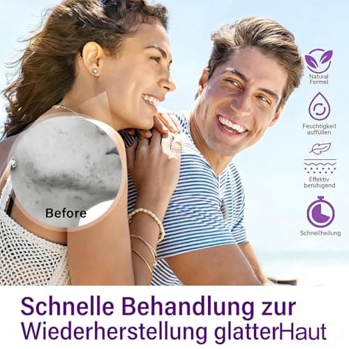 12% Azelaic Acid Serum - Anti-Pickel-Creme für rosAceatische Haut
| Azelainsäure Serum - Porenverkleinerung & Pickelred
