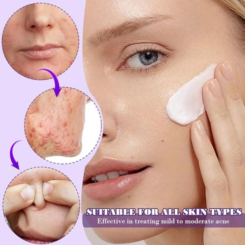12% Azelaic Acid Serum, Gesichtsserum gegen Rötungen für sensible Haut, Aufgehellte Haut mit Azelainsäure und Hyaluronsä