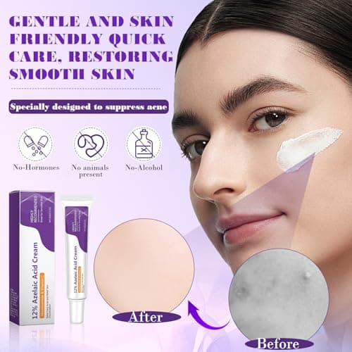 **Azelainsäure Gesichtserosionserdio Serum 12% für Frauen tegen Pickeln & Akne 20g**
| **Azelainsäure Gesichtserosionse