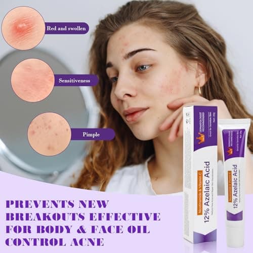 12% Azelaic Acid Serum, Gesichtsserum gegen Rötungen für sensible Haut, Aufgehellte Haut mit Azelainsäure und Hyaluronsä