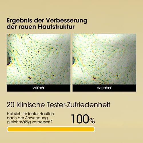 SOME BY MI Yuja Niacin Anti Blemish Serum - 10% Niacinamid & Vitamin C - Für reife Frauen - Perfekter für Nacht- & Morge