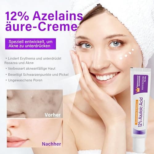 12% Azelaic Acid Serum - Anti-Pickel-Creme für rosAceatische Haut
| Azelainsäure Serum - Porenverkleinerung & Pickelred