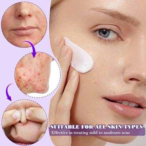 **Azelainsäure Gesichtserosionserdio Serum 12% für Frauen tegen Pickeln & Akne 20g**
| **Azelainsäure Gesichtserosionse
